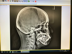 歯科用CT(3Dレントゲン)及びセファロ(矯正治療用レントゲン)